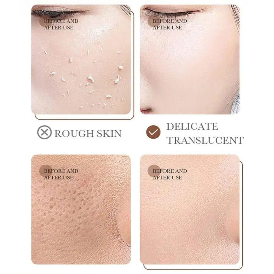 Rice Extract Exfoliating Gel – Gentle Dead Skin Remover for Soft & Smooth Skin