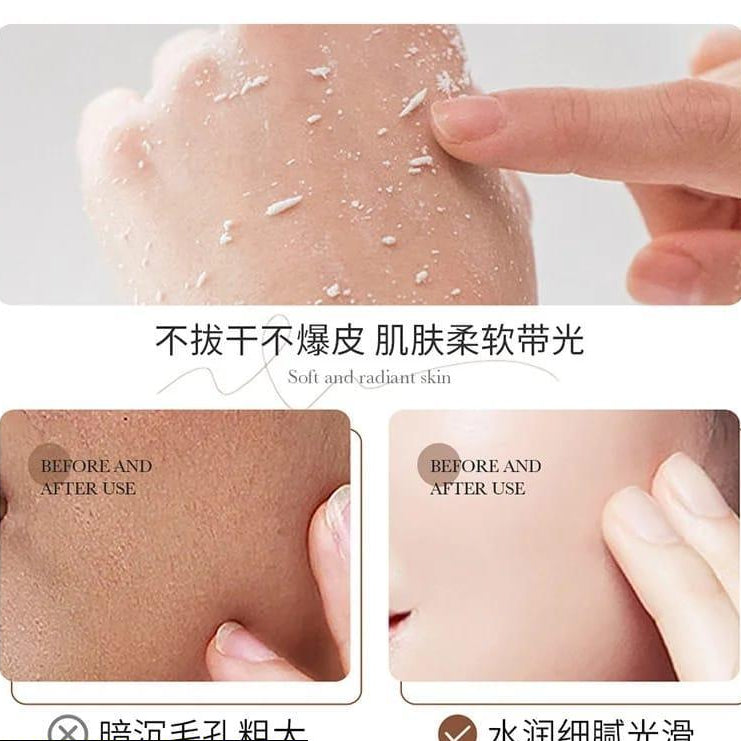 Rice Extract Exfoliating Gel – Gentle Dead Skin Remover for Soft & Smooth Skin